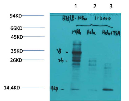Western blot analysis of 1) Mouse Brain Tissue, 2)Hela, 3)Hela+TSA Treated with Acetyl Lysine Mouse mAb EM1191 diluted at 1:2,000.
