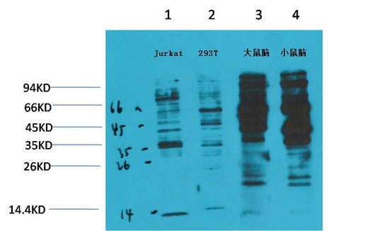 Western blot analysis of 1) Jurkat, 2) 293T, 3) Rat Brain Tissue, 4) Mouse Brain Tissue with Phosphotyrosine Mouse  mAb EM1194 diluted at 1:2,000.