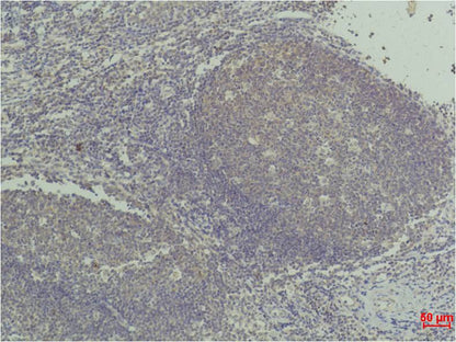 Immunohistochemical analysis of paraffin-embedded Human Tonsil Tissue using  TNF a(EM1197) Mouse mAb diluted at 1:50.