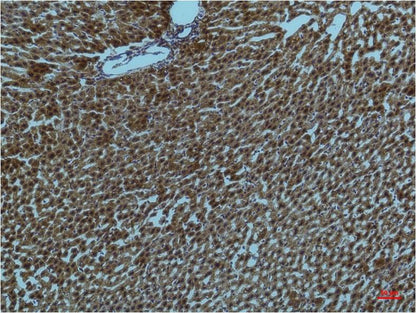 Immunohistochemical analysis of paraffin-embedded Rat Liver Tissue using PI3 Kinase P85 Alpha  (EM1209) Mouse mAb diluted at 1:200.