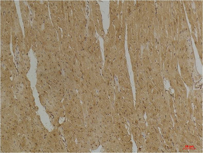Immunohistochemical analysis of paraffin-embedded Mouse Heart Tissue using Desmin (EM1218) Mouse mAb diluted at 1:200.