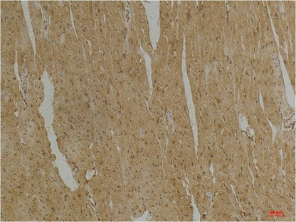 Immunohistochemical analysis of paraffin-embedded Mouse Heart Tissue using Desmin (EM1218) Mouse mAb diluted at 1:200.