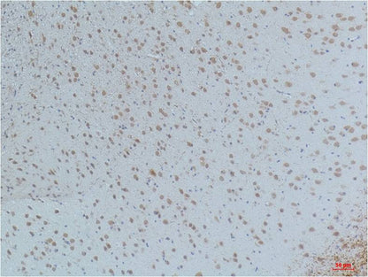 Immunohistochemical analysis of paraffin-embedded Mouse Brain Tissue using CaMKIIBeta/ Gamma /δ (Phospho Thr287) (EM1222)Mouse mAb diluted at 1:200.