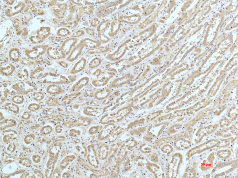 Immunohistochemical analysis of paraffin-embedded Human Kidney Tissue using a-actinin (EM1261) Mouse mAb diluted at 1:200.