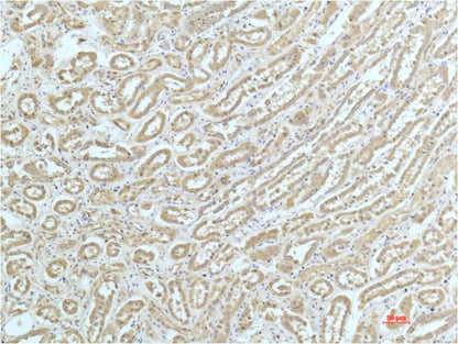 Immunohistochemical analysis of paraffin-embedded Human Kidney Tissue using a-actinin (EM1261) Mouse mAb diluted at 1:200.