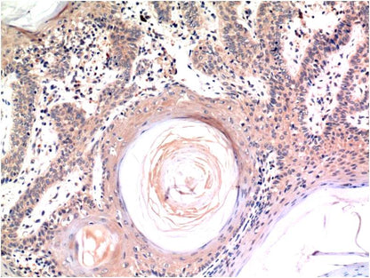 Immunohistochemical analysis of paraffin-embedded Human Skin Tissue using Caspase-3 (EM1266) Mouse mAb diluted at 1:200.