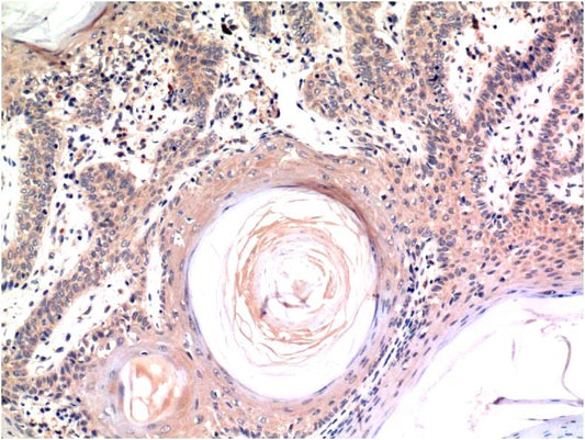 Immunohistochemical analysis of paraffin-embedded Human Skin Tissue using Caspase-3 (EM1266) Mouse mAb diluted at 1:200.
