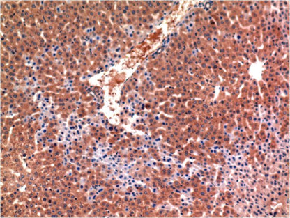 Immunohistochemical analysis of paraffin-embedded Mouse LiverTissue using Caspase-3 (EM1266) Mouse mAb diluted at 1:200.