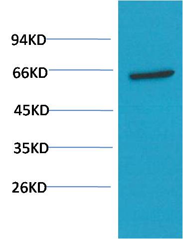 Western blot analysis of PC3 Cell Lysateusing Akt (EM1271) Mouse mAb diluted at 1:1000.