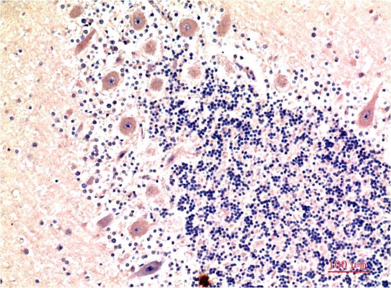 Immunohistochemical analysis of paraffin-embedded Human Brain Tissue using LC3B (EM1291) Mouse mAb diluted at 1:200.