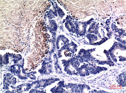 Immunohistochemical analysis of paraffin-embedded Human Stomach Tissue using Acetyl Histone H3 K9 (EM1292) Mouse mAb diluted at 1:200.