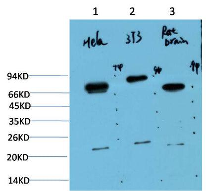 Western blot analysis of 1) Hela Cell Lysate, 2) 3T3 Cell Lysate, 3) Rat Brain Tissue Lysate using Ubiquitin (EM1296) Mouse mAb diluted at 1:1000.