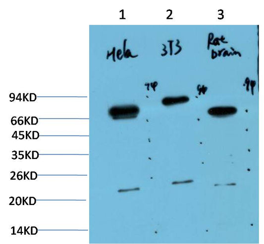 Western blot analysis of 1) Hela Cell Lysate, 2) 3T3 Cell Lysate, 3) Rat Brain Tissue Lysate using Ubiquitin (EM1296) Mouse mAb diluted at 1:1000.