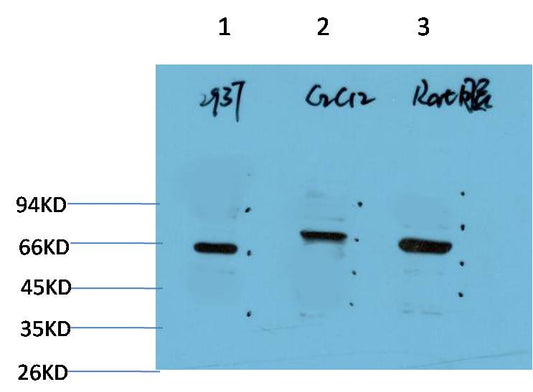 Western blot analysis of 1) 293T Cell Lysate, 2) C2C12 Cell Lysate, 3) Rat Brain Tissue Lysate using Beclin-1 ( EM1304 ) Mouse mAb diluted at 1:2000.