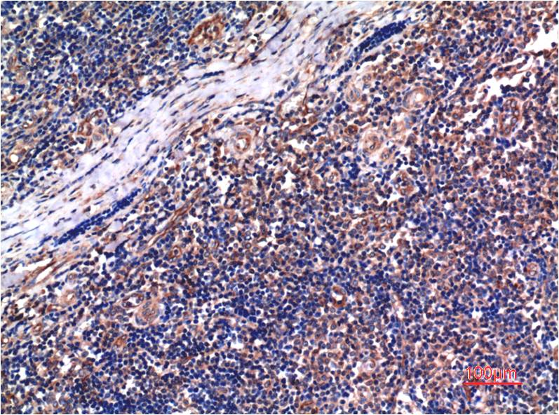 Immunohistochemical analysis of paraffin-embedded Human Tonsil Tissue using Cyclin B1 ( EM1310 ) Mouse mAb diluted at 1:200.