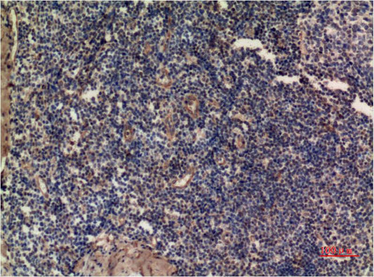 Immunohistochemical analysis of paraffin-embedded Human Tonsil Tissue using ERK1 (EM1323) Mouse mAb diluted at 1:200.