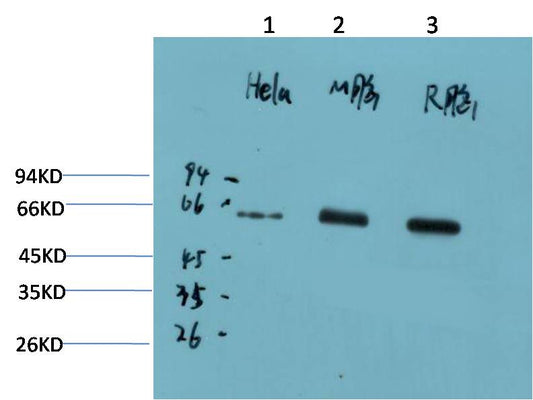 Western blot analysis of 1) Hela Cell Lysate, 2)Mouse Brain Tissue Lysate, 3) Rat Brain Tissue Lysate using AMPK a1 (EM1327) Mouse mAb diluted at 1:2000.