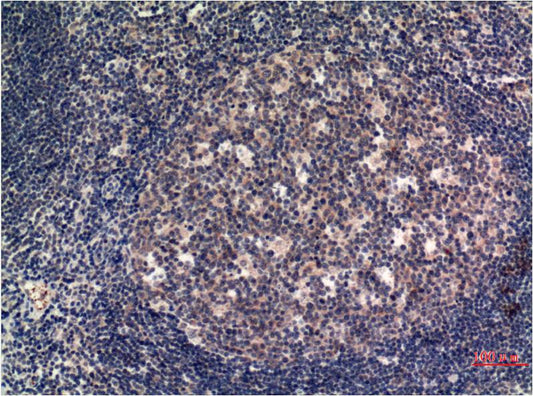 Immunohistochemical analysis of paraffin-embedded Human Tonsil Tissue using MLKL (EM1328) Mouse mAb diluted at 1:200..