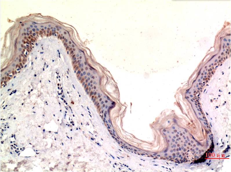 Immunohistochemical analysis of paraffin-embedded Human Skin Tissue using MLKL (EM1328) Mouse mAb diluted at 1:200.