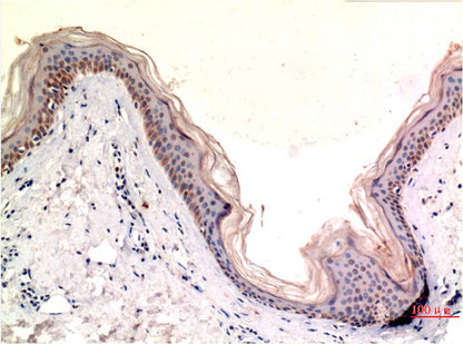 Immunohistochemical analysis of paraffin-embedded Human Skin Tissue using MLKL (EM1328) Mouse mAb diluted at 1:200.