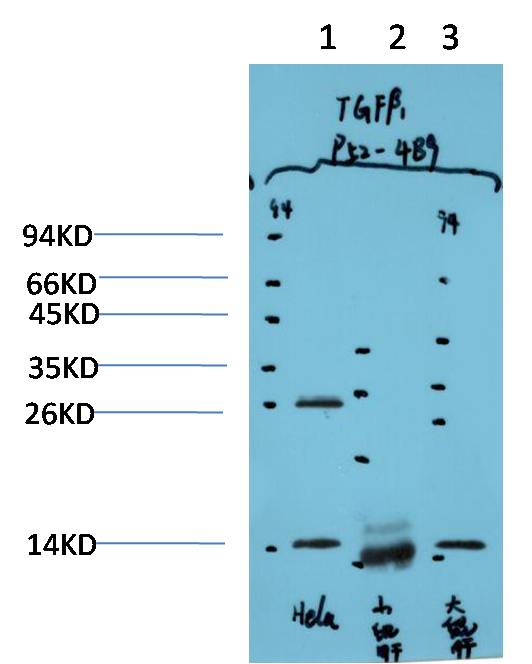 Western blot analysis of 1) Hela Cell Lysate, 2)Mouse Liver Tissue Lysate, 3) Rat Liver Tissue Lysate using TGFBeta1  (EM1334) Mouse mAb diluted at 1:1000.