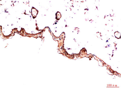 Immunohistochemical analysis of paraffin-embedded Rat Skin Tissue using PDGFR a (EM1336) Mouse mAb diluted at 1:200.
