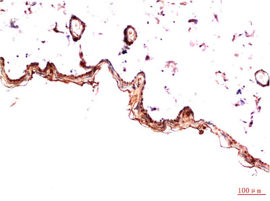 Immunohistochemical analysis of paraffin-embedded Rat Skin Tissue using PDGFR a (EM1336) Mouse mAb diluted at 1:200.