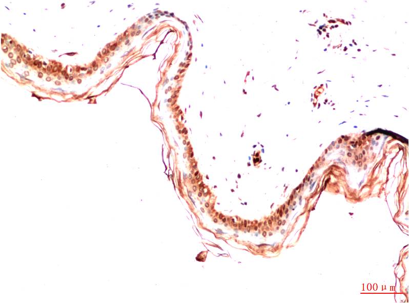 Immunohistochemical analysis of paraffin-embedded Human Skin Tissue using PDGFR a (EM1336) Mouse mAb diluted at 1:200