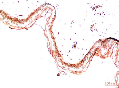 Immunohistochemical analysis of paraffin-embedded Human Skin Tissue using PDGFR a (EM1336) Mouse mAb diluted at 1:200