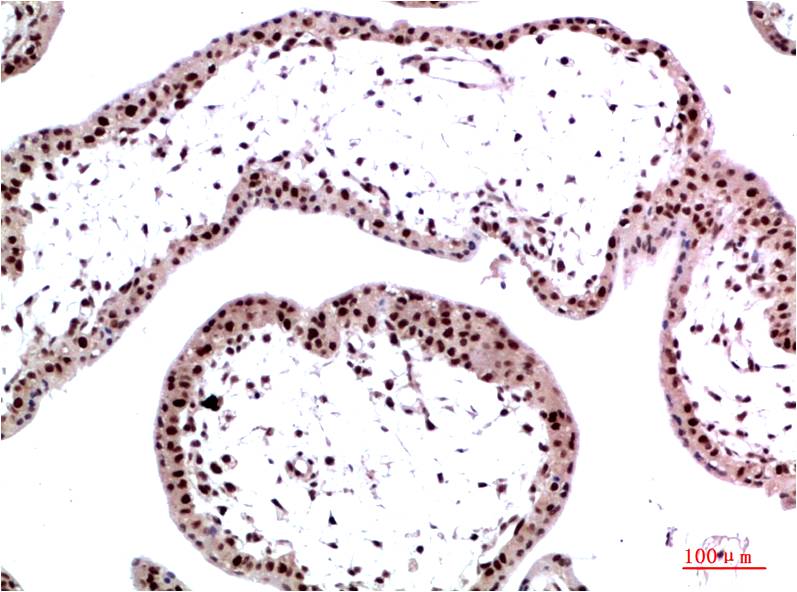 Immunohistochemical analysis of paraffin-embedded Human Placenta Tissue using HP-1Gamma  (EM1364) Mouse mAb diluted at 1:200.