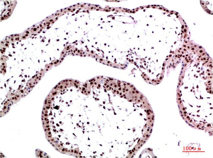 Immunohistochemical analysis of paraffin-embedded Human Placenta Tissue using HP-1Gamma  (EM1364) Mouse mAb diluted at 1:200.