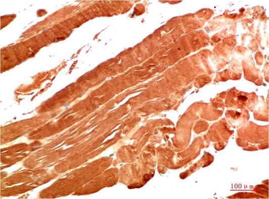 Immunohistochemical analysis of paraffin-embedded Human Skeletal Muscle Tissue using NBR1  (EM1373) Mouse mAb diluted at 1:200.
