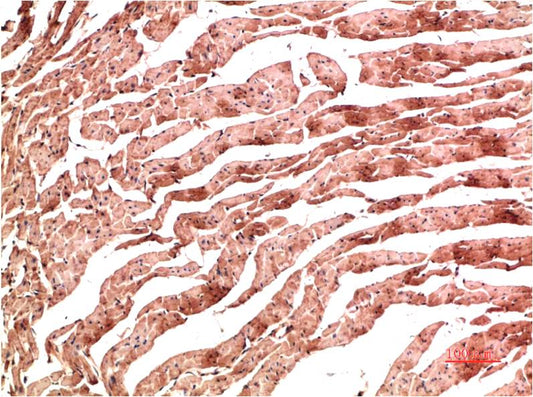 Immunohistochemical analysis of paraffin-embedded Rat Heart Tissue using VE-Cadherin  (EM1384) Mouse mAb diluted at 1:200.