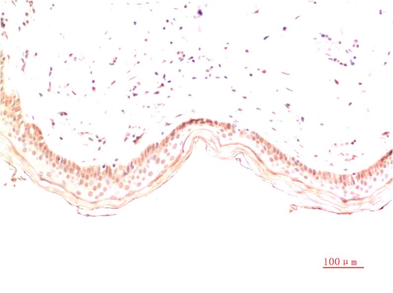 Immunohistochemical analysis of paraffin-embedded Human Skin Tissue using Collagen I  (EM1387) Mouse mAb diluted at 1:200.