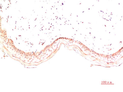 Immunohistochemical analysis of paraffin-embedded Human Skin Tissue using Collagen I  (EM1387) Mouse mAb diluted at 1:200.
