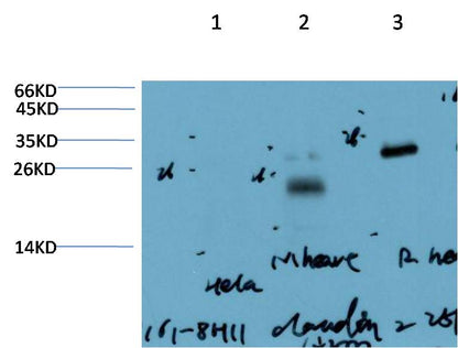 Western blot analysis of 1) Hela Cell Lysate, 2) Mouse Heart Tissue Lysate , 3) Rat Heart Tissue Lysate using Claudin-2  (EM1403) Mouse mAb diluted at 1:2000.