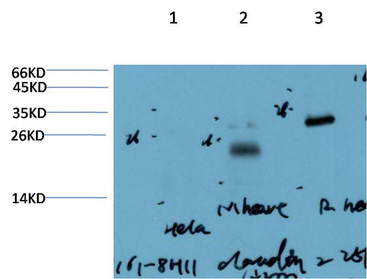 Western blot analysis of 1) Hela Cell Lysate, 2) Mouse Heart Tissue Lysate , 3) Rat Heart Tissue Lysate using Claudin-2  (EM1403) Mouse mAb diluted at 1:2000.