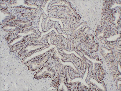 Immunohistochemical analysis of paraffin-embedded Human Prostate Tissue using P63-Alpha (EM1404) Mouse mAb diluted at 1:200.