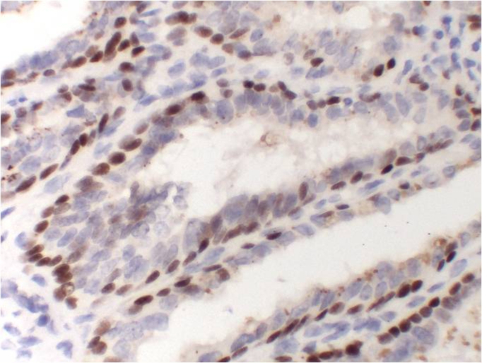 Immunohistochemical analysis of paraffin-embedded Human Prostate Tissue using P63-Alpha (EM1404) Mouse mAb diluted at 1:200.