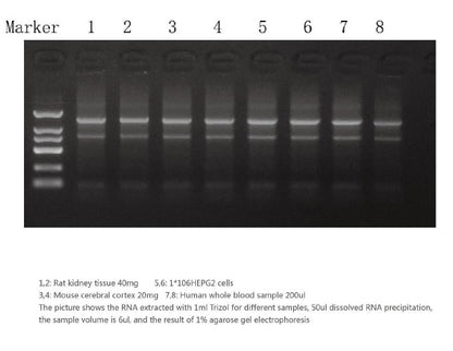 TRIpure Total RNA Extraction Reagent
