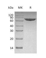 Recombinant Human MMP-2 (C-6His)