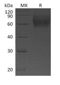 Recombinant Human IL-23R (C-6His)