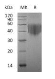 Recombinant Human B7-1 (C-6His)