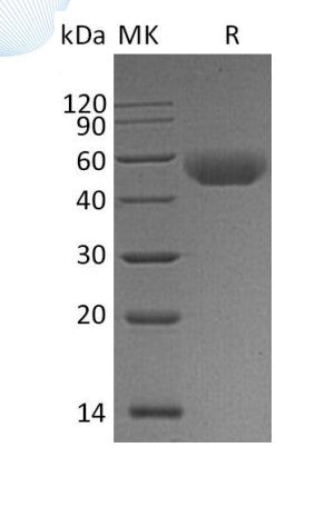 Recombinant Mouse CD5 (C-6His)