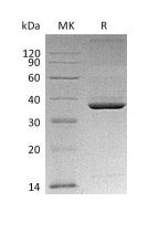 Recombinant Mouse ApoE (C-6His)