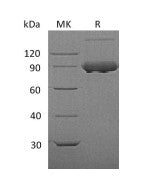 Recombinant Mouse TfR (N-8His)