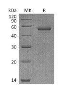 Recombinant Human NPTX1 (C-6His)