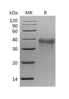 Recombinant Mouse TREM-1 (C-6His)