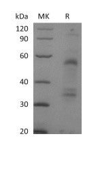 Recombinant Mouse HGF (C-6His)