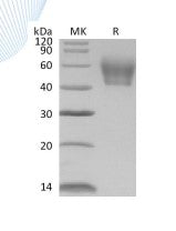 Recombinant Mouse IL-1R2 (C-6His)